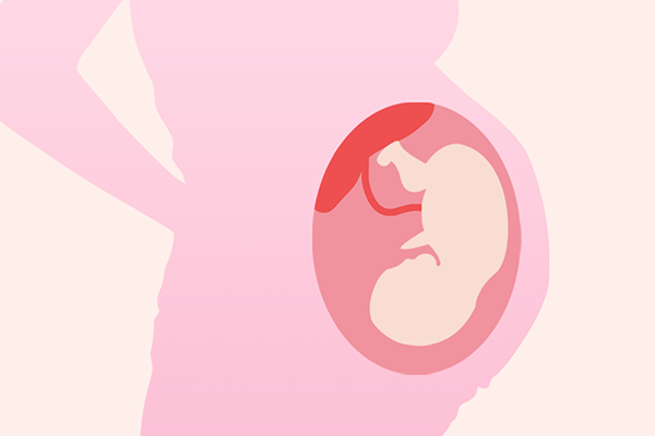 怀孕初期轻微出血 怀孕初期轻微出血是什么原因